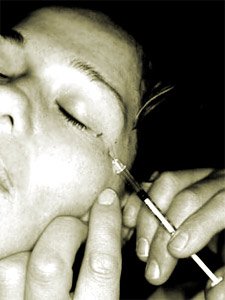 Botox